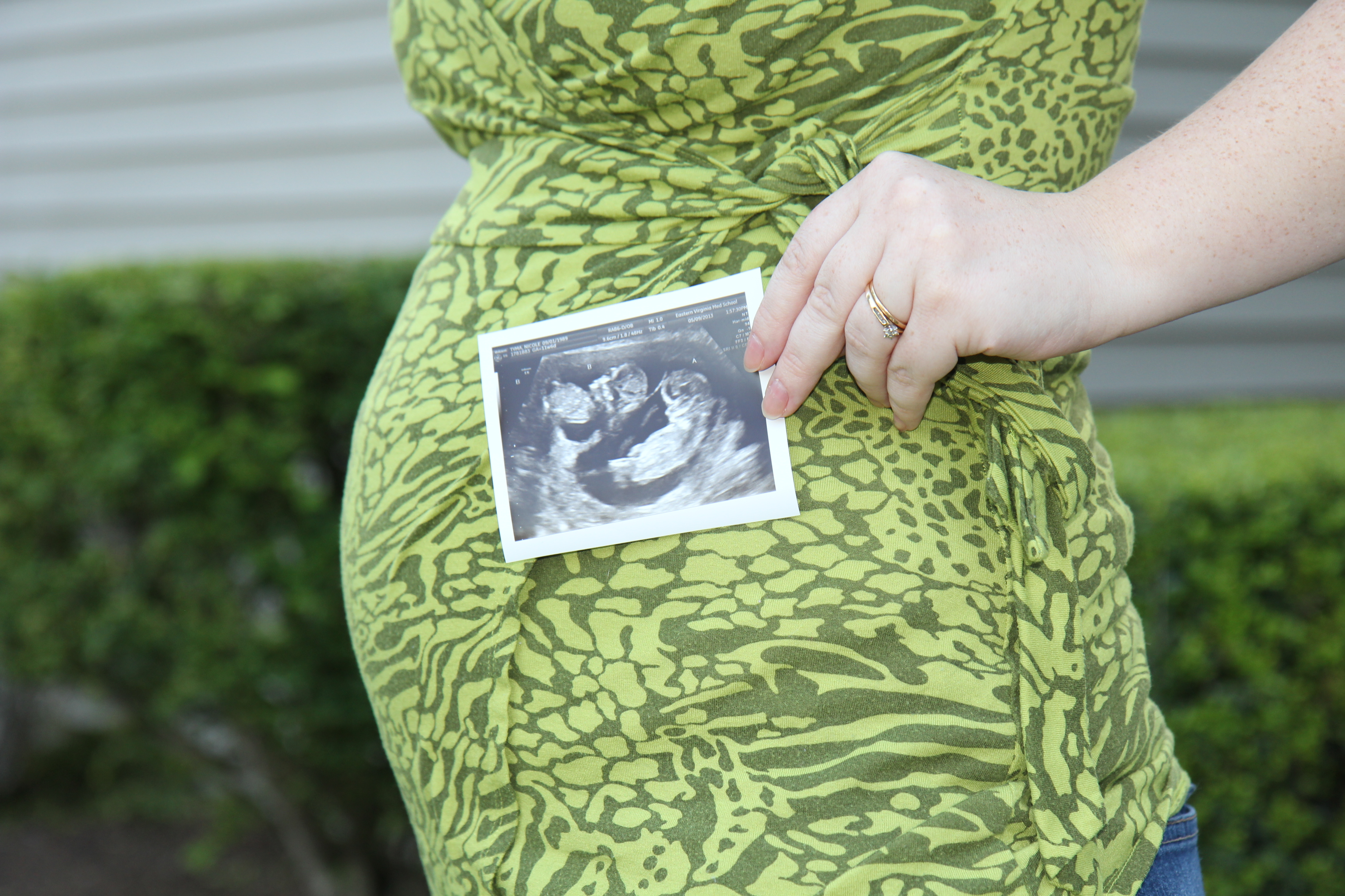 surrogate holding ultrasound photo in front of pregnant belly